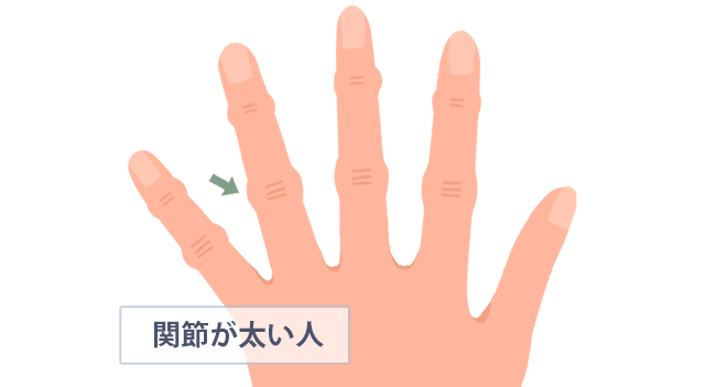指の根本より関節の方が太い人の手
